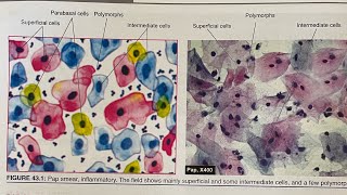 The Science of Cytological Stains How They Work Revealed  HampE  Papanicoloau stain [upl. by Lienad]