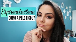 COMO A PELE FICOU DEPOIS DO TRATAMENTO COM ESPIRONOLACTONA PARA ACNE [upl. by Aenyl475]