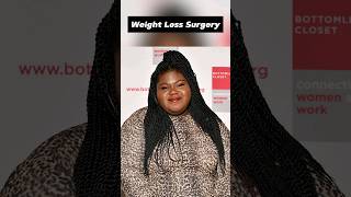 Celebrities Who Have Undergone Weight Loss Surgery shorts weightloss weightlossjourney [upl. by Haldi241]