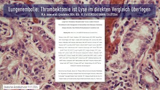 Lungenembolie Thrombektomie ist Lyse im direkten Vergleich überlegen [upl. by Calendre]