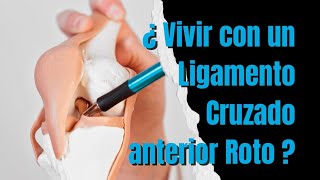 Vivir con un ligamento cruzado anterior roto  ¿ es posible  ¿ Qué consecuencias tiene [upl. by Coombs248]