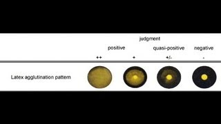 Latex Agglutination Test  Amrita University [upl. by Aymahs220]