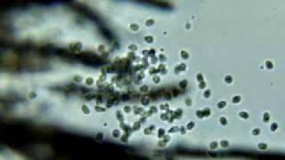 water mold zoospores [upl. by Vandyke]