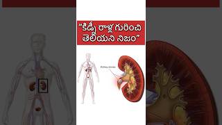 Unknown facts about kidney stones kidneystone telugufacts health [upl. by Costanzia179]