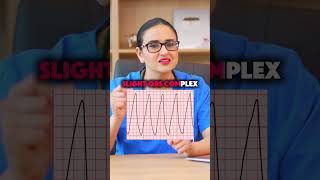 What Kind of ECG Is This Find Out What Your Heart’s Signals Meanshorts [upl. by Stephi]