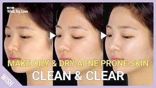 5 Essentials for Oily Dry Acne Prone Skin How to Get Clear Skin at Home  Wish Try Love [upl. by Man]