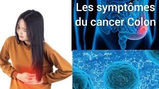 Les symptômes du cancer du colon [upl. by Vashtee]