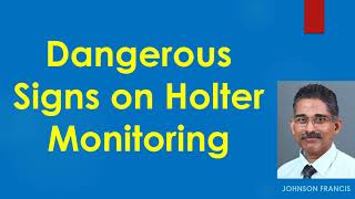 Dangerous Signs on Holter Monitoring [upl. by Irahcaz806]