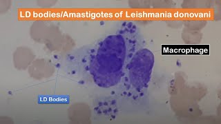 LD bodies Amastigotes of Leishmania donovani in skin smear of a cutaneous leishmaniasis patient [upl. by Airehc]