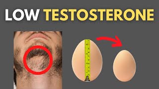 5 Signs Of LOW TESTOSTERONE Check your Testosterone [upl. by Leahplar]