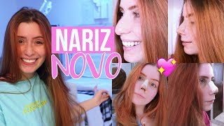 VLOG MINHA RINOPLASTIA CIRURGIA NO NARIZ [upl. by Hiro]