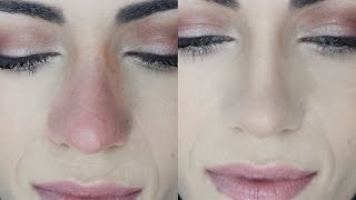 How To Cover Nose REDNESS And MAKE IT LAST  MakeupAndArtfreak [upl. by Sheeb965]