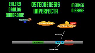 USMLE Step 1  Lesson 23  Osteogenesis Imperfecta Ehlers Danlos Syndrome and Menkes disease [upl. by Lekkim572]