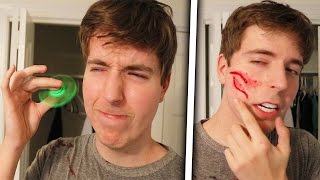 Fidget Spinner Vs Face Legit Had To Get Stitches [upl. by Arjan]