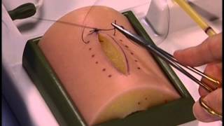 Simple Interrupted wound closure [upl. by Enelahs]