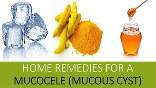 Home Remedies for a Mucocele Mucous Cyst  Home Remedies To Treat Mucocele [upl. by Lorre]