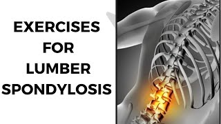 Best exercises to treat lumber spondylosisexercises for back painPhysiotherapyTreatments [upl. by Arreis]