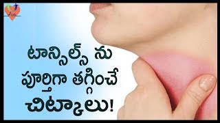 టాన్సిల్స్ ను పూర్తిగా తగ్గించే చిట్కాలు   Best Natural Home Remedies To Cure Tonsillitis  Arogya [upl. by Nivra202]