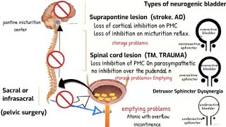 Neurogenic bladder and Micturition reflex [upl. by Rabbaj]