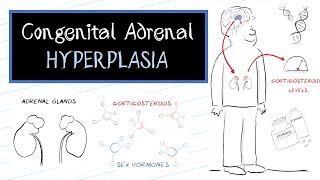 What is Congenital Adrenal Hyperplasia CAH [upl. by Baggett]