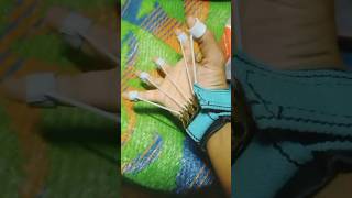 Finger Grip Exerciser  physiotherapy paralysis exercise shorts yt [upl. by Nilam]