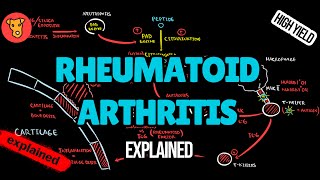 RHEUMATOID ARTHRITIS Pathogenesis EULAR Guidline diagnostic criterias Xray Treatment [upl. by Blackington]