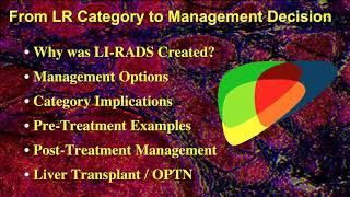 21 Management Implications of LIRADS Categories  Part 1 By Prof Dr Donald Mitchell [upl. by Dunn]