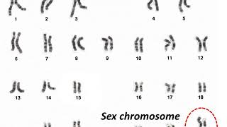 आनुवंशिकता और विकास – Heredity and Sex Chromosome – Hindi [upl. by Pinette]