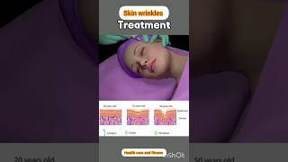 skin wrinkles treatment at home asmr ramdy for wrinkle [upl. by Hayouqes]