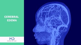 Cerebral Edema Causes Symptoms Diagnosis and Treatment Options [upl. by Ardnoyek]