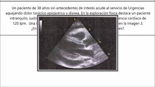 Preguntas IMPRESCINDIBLES de cardiología para el MIR [upl. by Llenna]