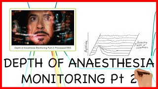 DEPTH OF ANAESTHESIA MONITORING PART 2  PHYSICS SERIES [upl. by Migeon224]