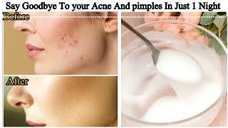 I applied👆🏼this on my Small Bumps Pimples Whiteheads amp AcneGot Clear Smooth Skin in Just 3 Days [upl. by Star]