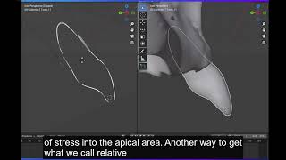 Tooth movement explained with an open source software [upl. by Nalliuq592]