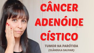 Câncer adenóide cístico [upl. by Ailecec]