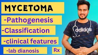 Mycetoma microbiology  Madura footeumycetomaActinomycetomalab diagnosis treatment [upl. by Wallach685]