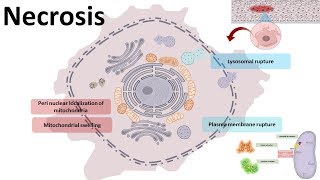 Necrosis  cellular mechanism and types [upl. by Adnamaa430]