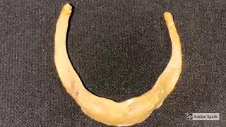 Hyoid bone [upl. by Ries]