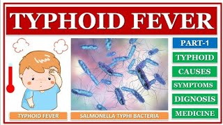 typhoid disease class 12th and neet [upl. by Hatfield]