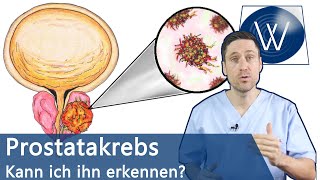 Prostatakrebs Gibt es Risikofaktoren und welche Symptome können auftreten Vorsorge amp Therapie [upl. by Ballard427]