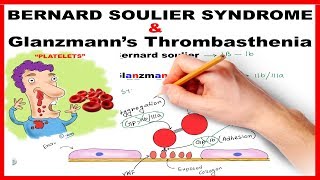 Bernard Soulier Syndrome amp Glanzmanns Thrombasthenia  Mnemonic Series  21 [upl. by Randall]