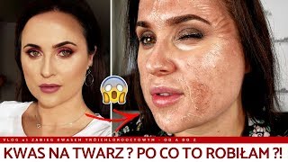 KWASY NA TWARZ  RECENZJA PEELINGU CHEMICZNEGO VLOG [upl. by Norina]