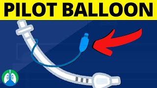 Pilot Balloon Medical Definition  Quick Explainer Video [upl. by Aztirak]