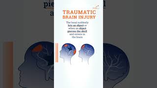 What is a traumatic brain injury [upl. by Earb]