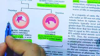 Ischemic heart diseasePathology of Ischemic heart diseaseAcute plaque changesRobbins pathology [upl. by Gniliem]