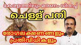 ചെള്ള് പനി കേരളത്തിലും  Scrub Typhus Symptoms and precuations [upl. by Cherice]