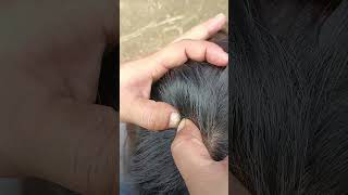 insects nomorelice satisfying hair lice animals hairlice piercing headlice [upl. by Gervais282]