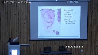 Pathology and Pathogenesis of Leprosy Dr Priyanka Agarwal [upl. by Iadrahc]