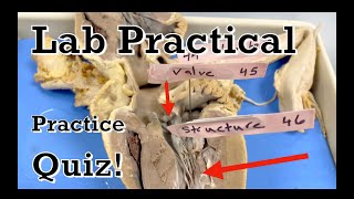 Heart Dissection Practice Quiz  Human Anatomy and Physiology [upl. by Ahseen]