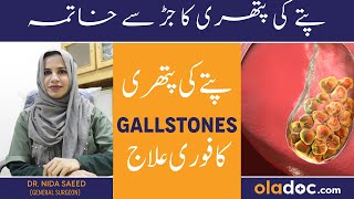 Pitay Me Pathri Ka Ilaj  Gallstones Symptoms And Treatment  Pitte Ki Pathri Ka Dard Kahan Hota Hai [upl. by Norton]